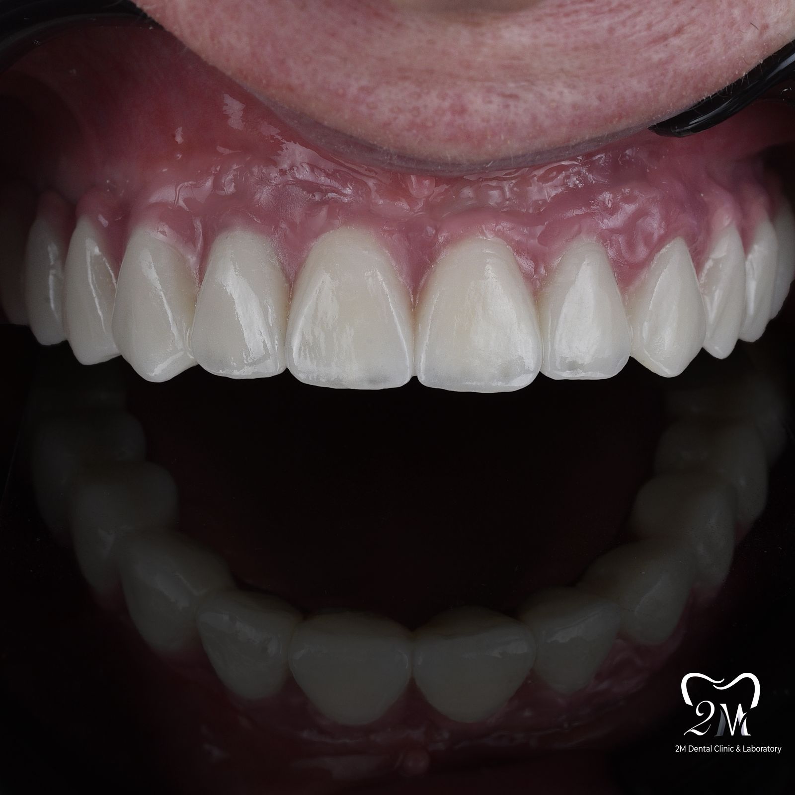 1implantology
