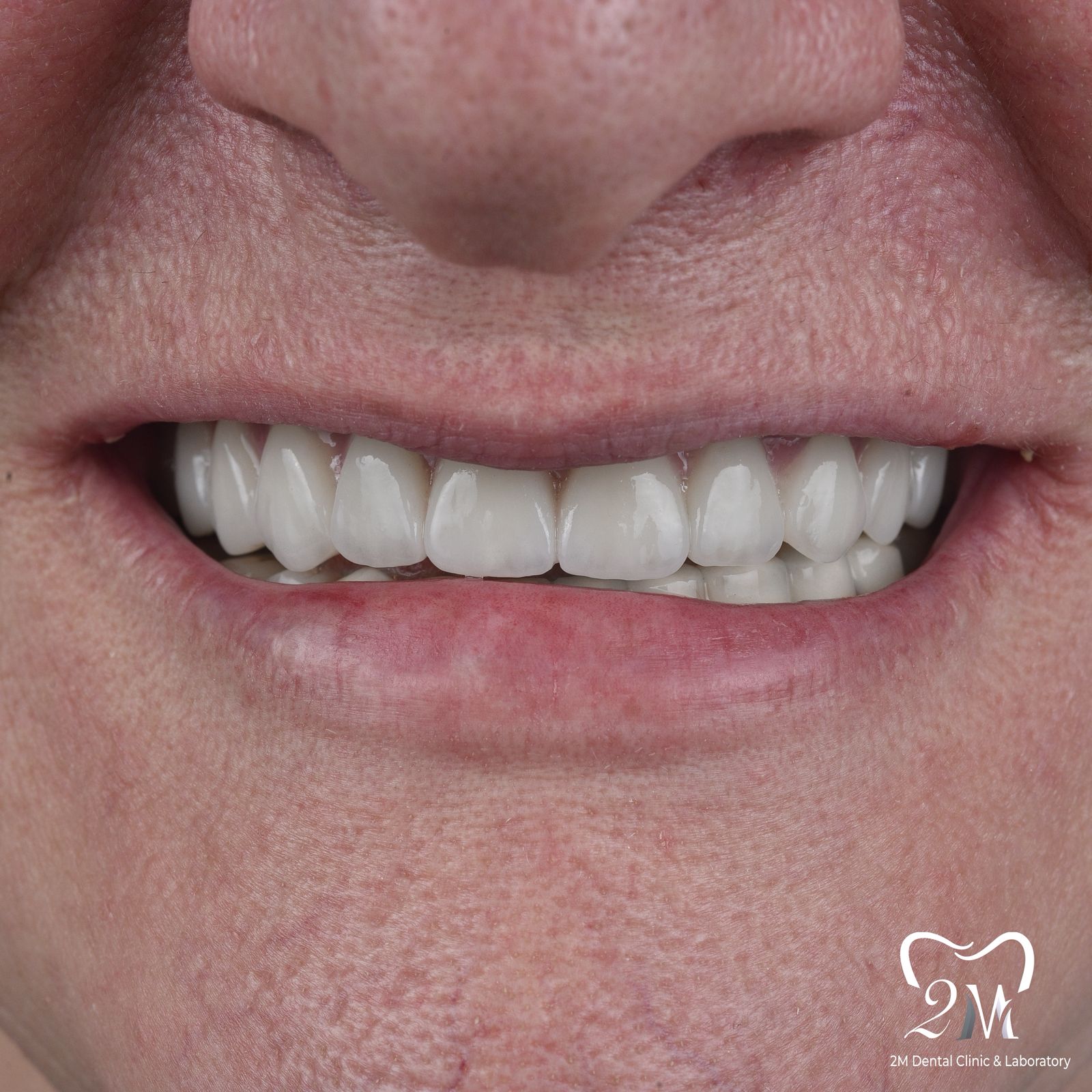 3implantology
