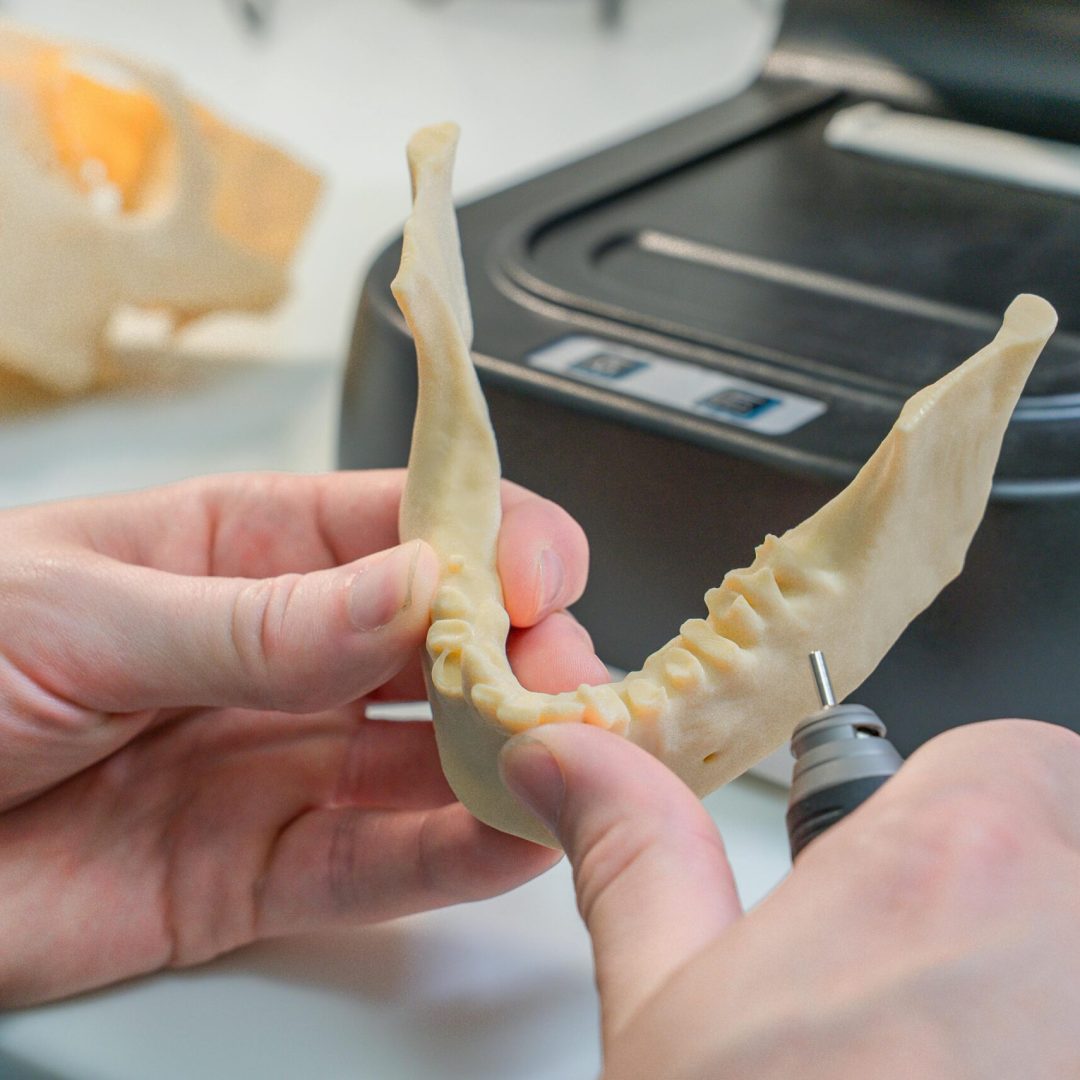 Detailed view of a 3D printed dental model being refined by a technician in a laboratory.